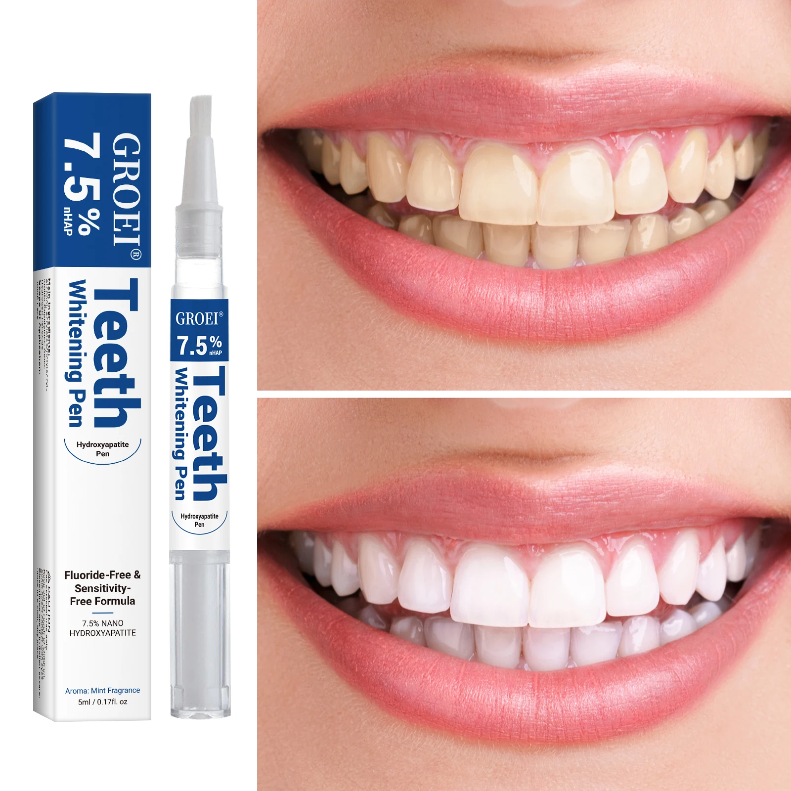 Hydroxyapatite Zahnaufhellungs – Teeth Whitening Pens Bewertung und Preis