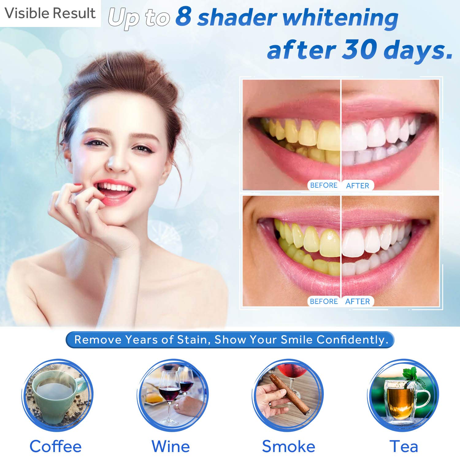 Zahnaufhellungsgel, Nachfüllsp – Teeth Whitening Pens Bewertung und Preis