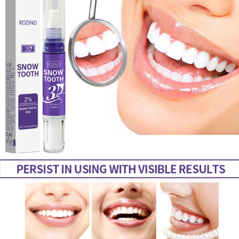 Unisex Mundpflege-Stift Anti-P – Teeth Whitening Pens Bewertung und Preis